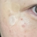 민속촌입구버스정류장_R | 대전 피부관리샵 프리진뷰티에서 기미·잡티관리 받은 솔직후기