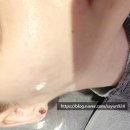 YP SKIN Therapy (YP 스킨 테라피)
