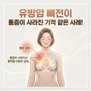 영강힐링센터치유생활단식센터 | 유방암 뼈 전이 환우가 미쯔이주열기 체험 후 통증이 사라진 후기