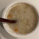 신촌 라이크 치과 추천! 사랑니발치 가격, 후기 😬