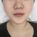 물광피부관리 아이린뷰티 아카데미 성북점 스킨업 케어 후기