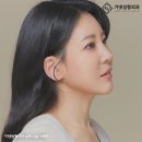가넷성형외과의원 | 안면거상술후기 탄력이 무너져 고민이라면