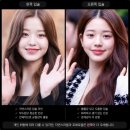 거울아 거울아 | [입술필러]시술 전 예상 모습, 입술 필러 비율 고민 끝! 💋미리 알아보자.