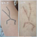 진담성형외과 네이버블로그