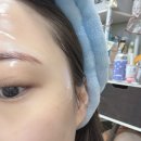 부천신중동피부관리 (인셀덤) 배우크림으로 유명한 곳