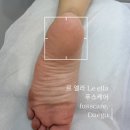 [수성구 풋케어] 르 엘라 푸스 케어 후기