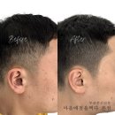마음에점을찍다두피SMP 이미지