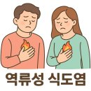 에소메프라졸 역류성 식도염 약, 복용 후기 부작용 복용 기간 총정리