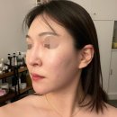 대구 수성구 에스테틱 윤곽관리 효과쩌는 뷰티즘 솔직후기