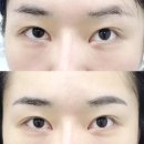 성현로 | [서울 관악구] 관악드림타운상가 뷰티샵 &#34;홍에스테틱&#34;에서 눈썹 후기