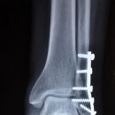 김성태정형외과의원 이미지