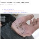 은물, 은용액은 아토피에 정말 효과가 있을까요?