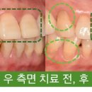 연세바른치과 이미지