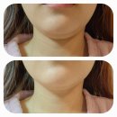 정한의원 | [분당 다이어트 한약/밀감정] 한의원 비대면 진료받아본 후기