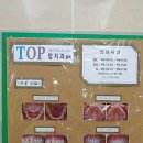 용인탑치과의원 네이버블로그