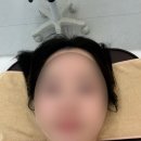 풍성한 집 | 평택윤곽관리 예봄뷰티 3V윤곽관리 후기 평택작은얼굴관리