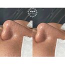 쏨에스테틱 - 동해시 | 쏨에스테틱