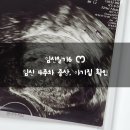 임신일기6 ෆ 임신 극초기, 4주차 증상 │ 아기집 확인 │ 임테기 진하기 비교 │ 임밍아웃
