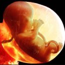 청혈한의원 이미지