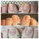 큐어짐 이미지