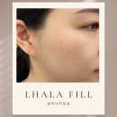 [미녀작업실]옥정 피부관리/피부톤 개선, 콜라겐 필링 라라필 후기