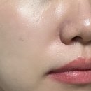 주식회사 메디칼솔루션컴퍼니 | 얼굴 각질 제거 필링팩 루아더컴퍼니 스피큘팩 후기