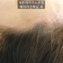 세븐노은 이미지