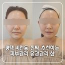 위드미 평택중앙점 | 평택 비전동 &#39;위드미&#39;에서 피부관리 윤곽관리 받은 후기