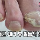 레푸스 화정점 이미지