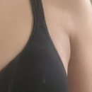 11545-05-15-33 | [부유방 유선제거 수술 후기] 05. 수술 후 15~33일차