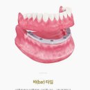 서울리오치과의원 네이버블로그
