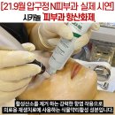 압구정메디필 네이버블로그