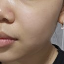 유산균토너 추천 큐라씨온 락토케어 카밍 토너 후기