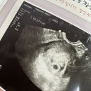향남피부과의원 | 임신 5주차, 산부인과에서 아기집 발견 및 임신확인서 발급 (단축근무 시작)
