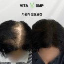 강동-천호-2410 | 서울두피문신 잘하는 곳, 꼭 확인하고 가세요