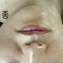 임스테라피 네이버블로그