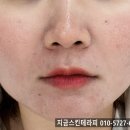 용카 | 다산에스테틱 아로마 용카 제품으로 예민,민감피부 진정관리 후기