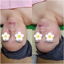 경화에스테틱