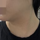 유노성형외과의원 네이버블로그