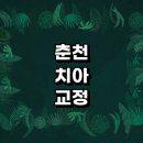 춘천시 치아교정 잘하는 전문치과 병원 추천 | 비용 후기 설측교정 돌출입 앞니 투명 무턱 부분 교정기...