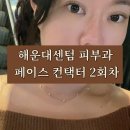 부산쥬베룩볼륨 vs 콜라겐컨택터, 콜라겐주사 내돈내산 비교후기