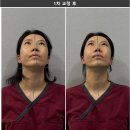 대안한의원 | 부산안면비대칭교정 1회차 후기 | 한의원 교정으로 느낀 변화