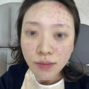 뷰티온의원 광주첨단 네이버블로그