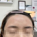 헤어끌레어