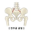 천추골 골절 [sacral fracture]근골격질환 이미지