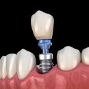 잘씹는치과의원 이미지