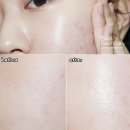 함창약국 | 아벤느 시칼파트 재생크림 약손몰에서~