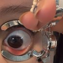 안경,원트 | 렌즈프리 아이오프너 렌즈끼는 도구 초보자들 렌즈 쉽게 끼는법 솔직후기와 중국꺼랑 비교