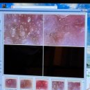 B10 | 대구 모공 피지 관리 B10에스테틱 후기