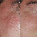 오로라 뷰티 이미지